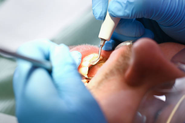 Best Urgent Dental Care for Toothaches in South Haven, MI