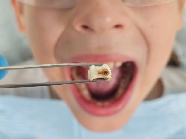 Best Emergency Denture Repair in South Haven, MI